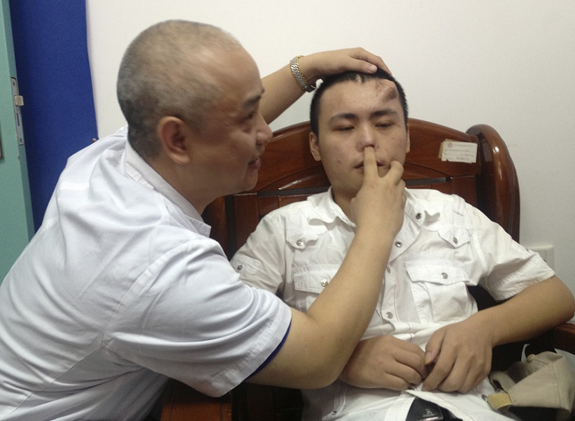 A doctor checks the infected and deformed nose of Xiaolian, before replacing it with a new nose, grown by surgeons on his forehead, at a hospital in Fuzhou