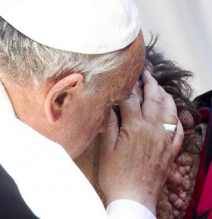 Papa Francesco bacia malato 3