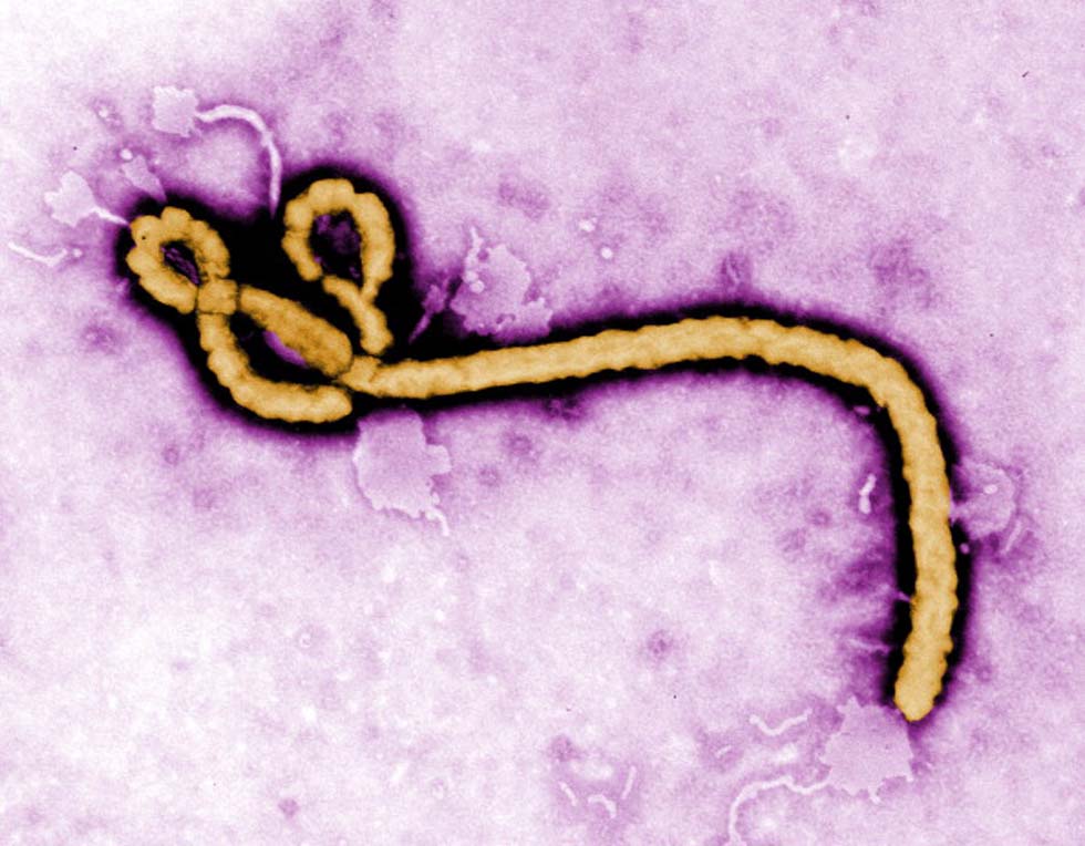 Il virus ebola visto al microscopio - Foto: Center for Disease Control (CDC) via Getty Images 